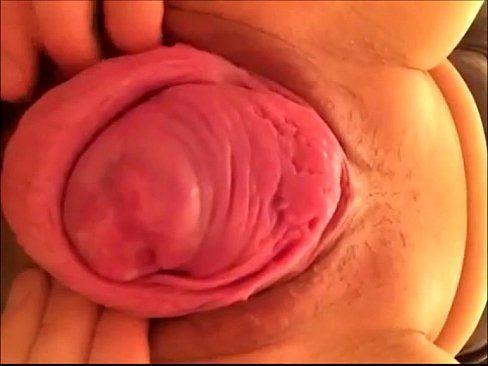 best of Prolapse fuck pussy