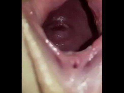 best of Cervix gaping pussy