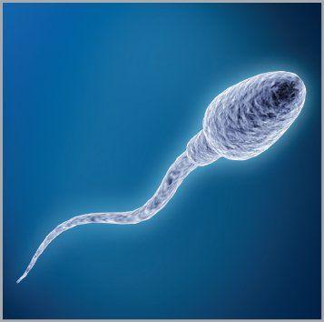 best of A of A sperm picture