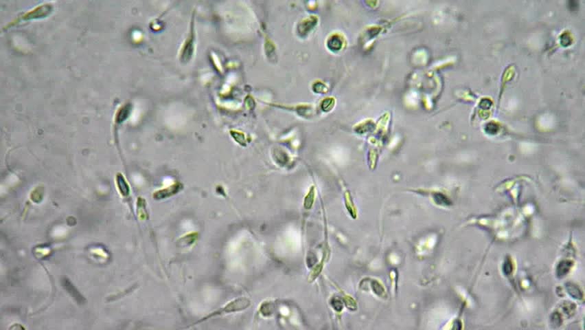 Defense reccomend Sperm cells 400x