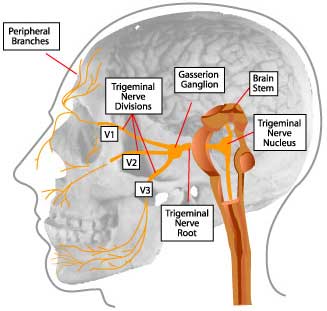 best of Teeth facial nerves wisdom Impacted and