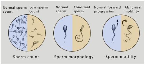 Sperm low motility fertility