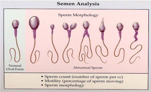 Male sperm colors