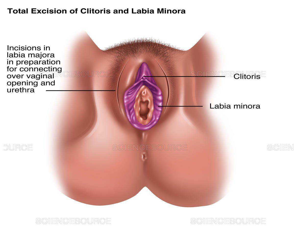 best of The performed on Medical clitoris procedures