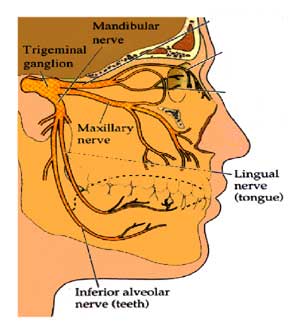 Impacted wisdom teeth and facial nerves