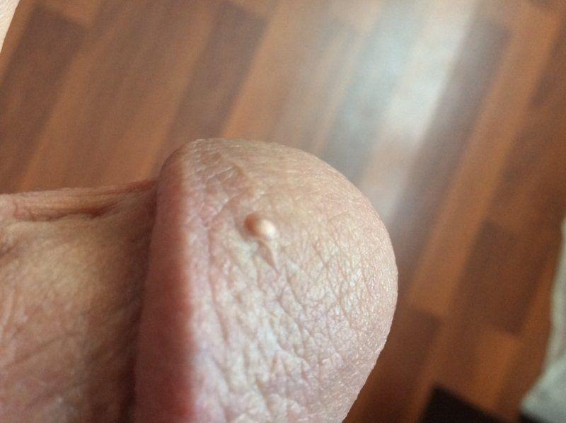Crusher reccomend Real homemade anal clips