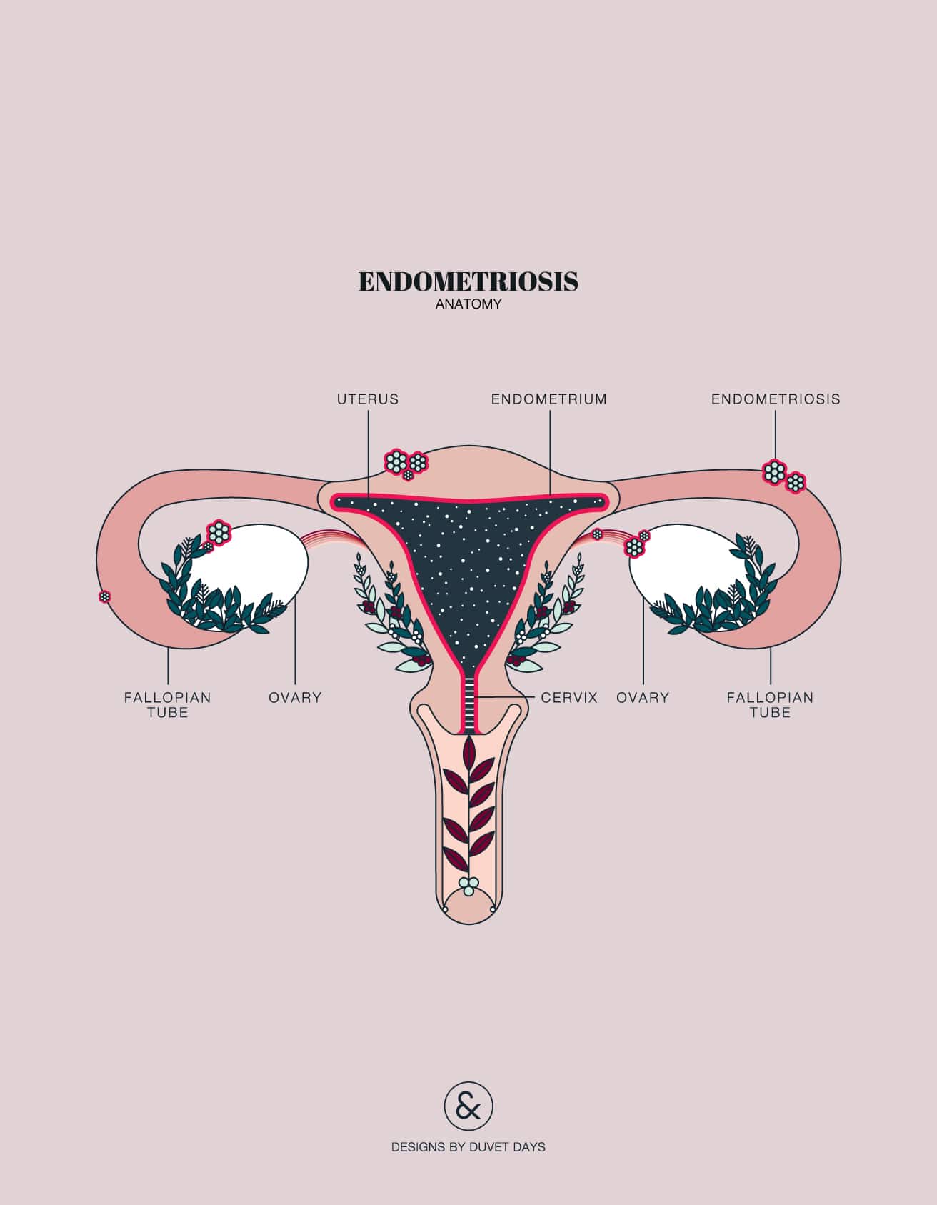Armed F. reccomend Endometriosis in the clitoris