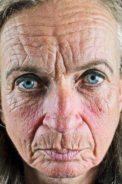 best of Skin symptoms Facial
