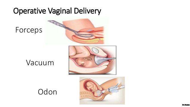 best of In vagina Cork
