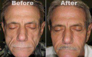 best of Treatments Facial wasting
