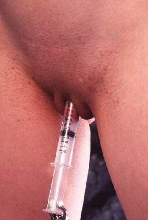 Suction pumping clitoris movies