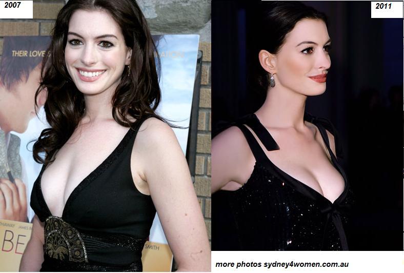 best of Off shows Anne boobs hathaway her
