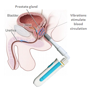Best Prostate Orgasm