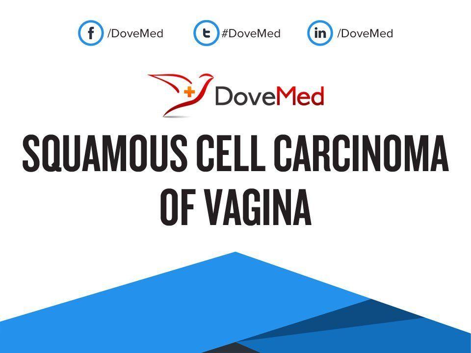 Doppler reccomend Cell found inside only search vagina