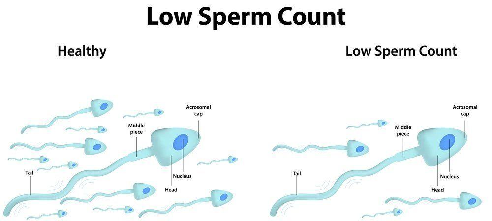 Mustang reccomend Sperm low motility fertility