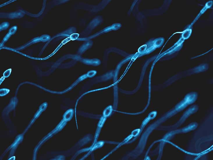 A picture of a sperm