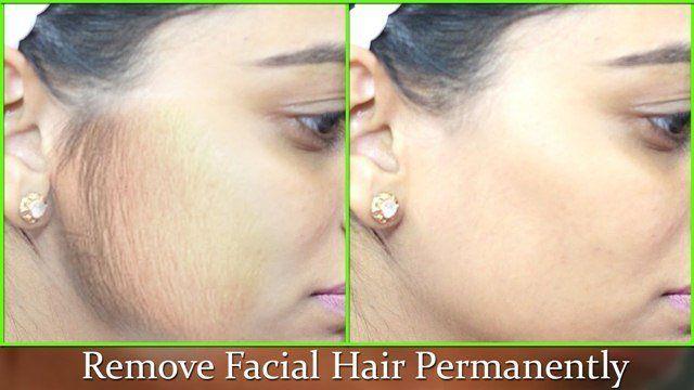 best of Of facial permanently hair Get rid