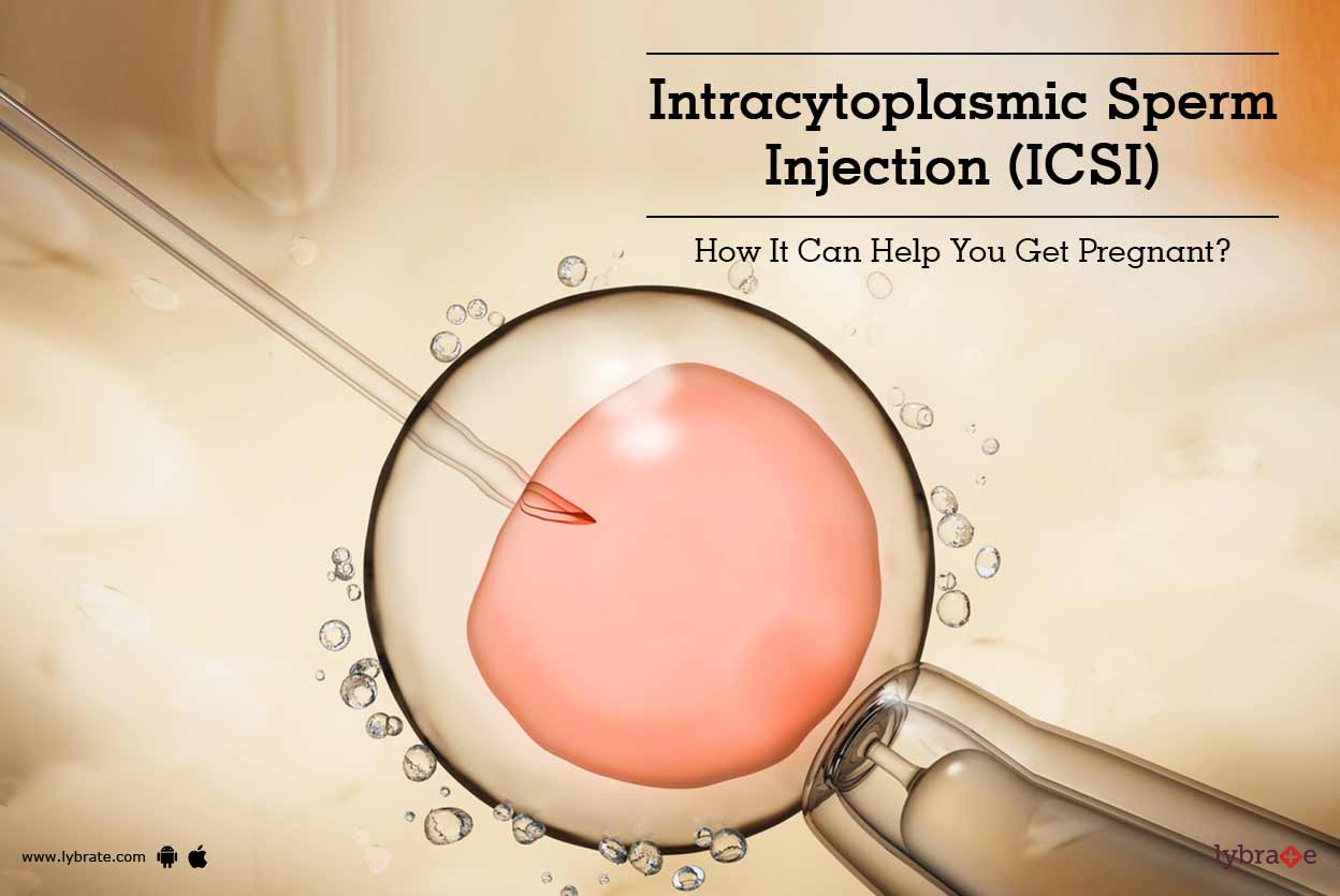 best of Intracytoplasmic injection Icsi sperm