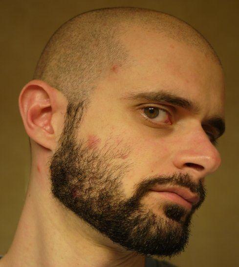 Rain D. reccomend Shaved neck beard