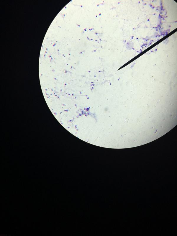 Sperm cells 400x