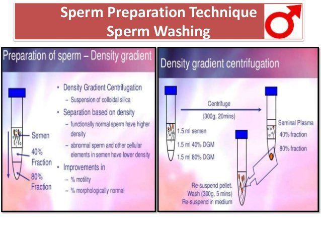 NFL reccomend Sperm hiv wash