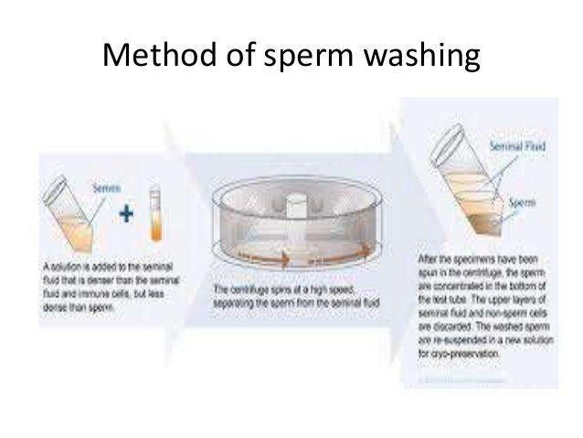 Sperm hiv wash